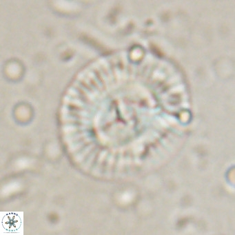 Coccolithus biparteoperculata VR 025539