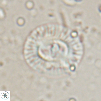 Coccolithus biparteoperculata VR 025540