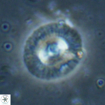Coccolithus biparteoperculata VR 025542