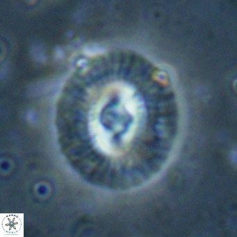 Coccolithus biparteoperculata VR 025544