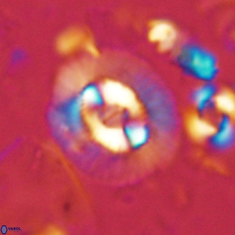 Coccolithus biparteoperculatus VR 02460