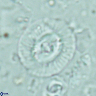 Coccolithus biparteoperculatus VR 02464