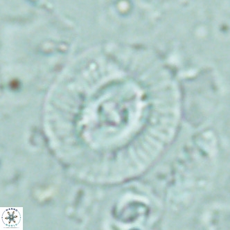 Coccolithus biparteoperculatus VR 02464