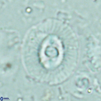 Coccolithus biparteoperculatus VR 02465
