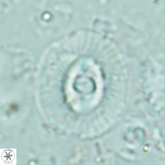 Coccolithus biparteoperculatus VR 02465