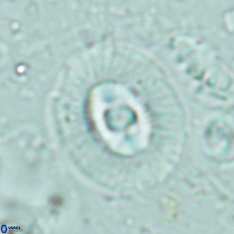 Coccolithus biparteoperculatus VR 02466