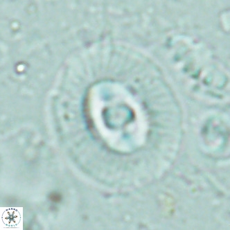 Coccolithus biparteoperculatus VR 02466