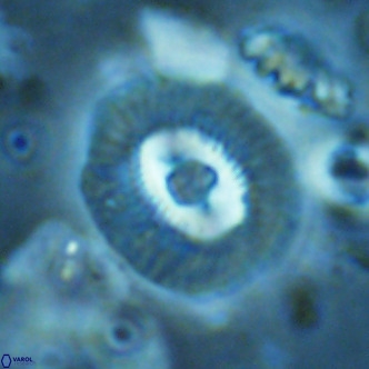 Coccolithus biparteoperculatus VR 02467