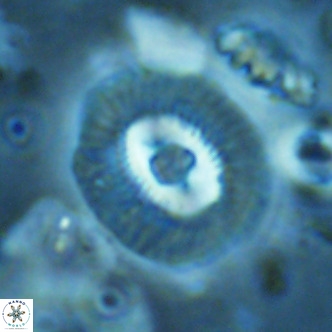 Coccolithus biparteoperculatus VR 02467