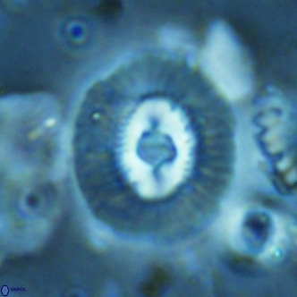 Coccolithus biparteoperculatus VR 02468