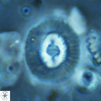 Coccolithus biparteoperculatus VR 02468