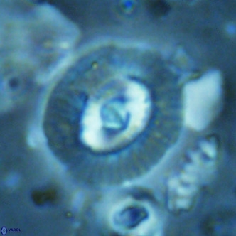 Coccolithus biparteoperculatus VR 02469
