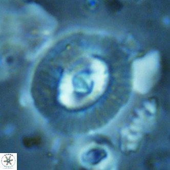 Coccolithus biparteoperculatus VR 02469