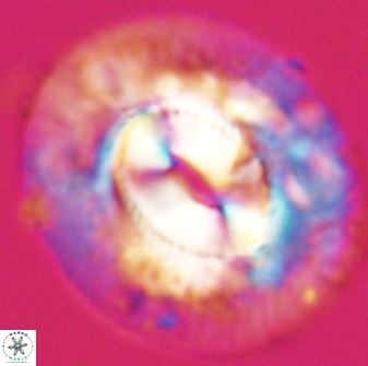 Coccolithus cf miopelagicus 22777