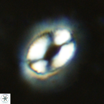 Coccolithus crassus VR 10767