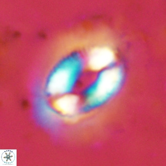 Coccolithus crassus VR 10768