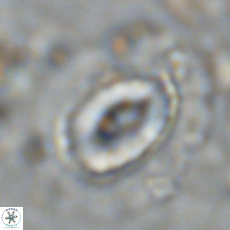 Coccolithus crassus VR 10769