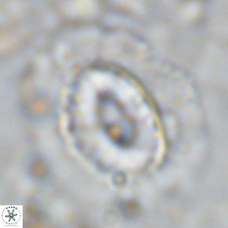 Coccolithus crassus VR 10774