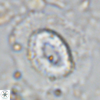 Coccolithus crassus VR 10775