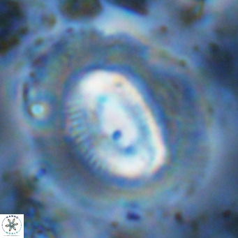 Coccolithus crassus VR 10776
