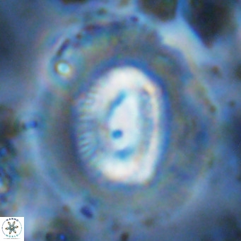 Coccolithus crassus VR 10777