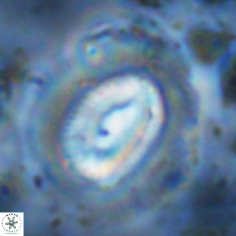 Coccolithus crassus VR 10778
