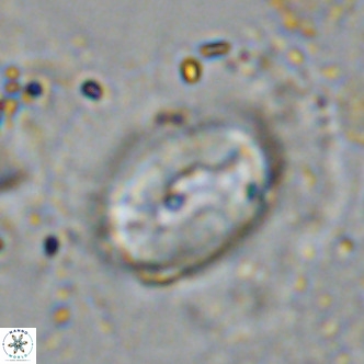 Coccolithus crassus VR 10770