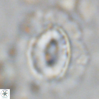 Coccolithus crassus VR 10771