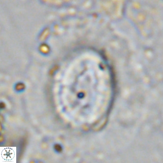 Coccolithus crassus VR 10772