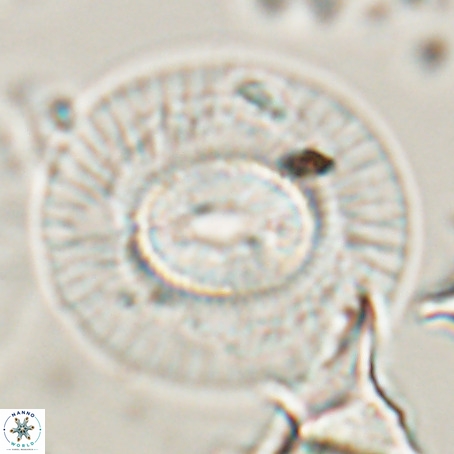 Coccolithus eopelagicus VR 026287