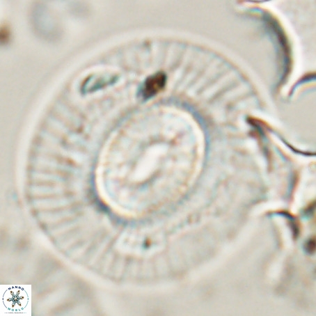 Coccolithus eopelagicus VR 026289