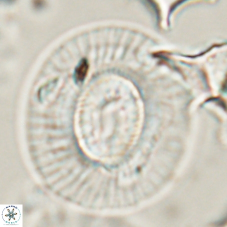 Coccolithus eopelagicus VR 026290