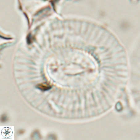 Coccolithus eopelagicus VR 026292
