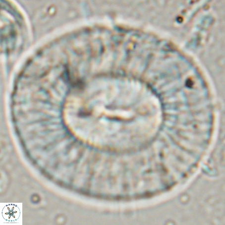 Coccolithus eopelagicus VR 027891