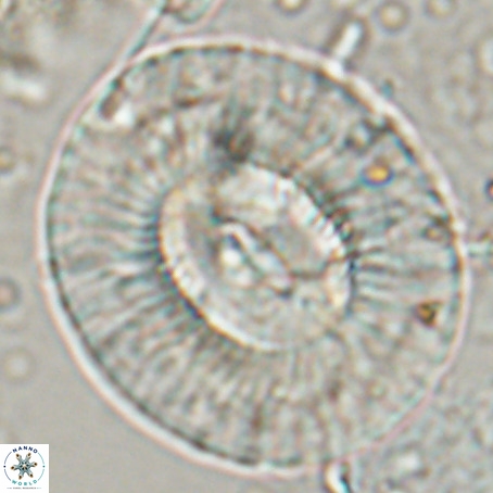Coccolithus eopelagicus VR 027892