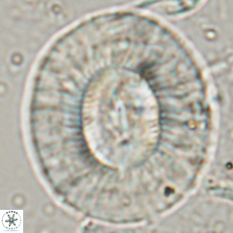 Coccolithus eopelagicus VR 027893