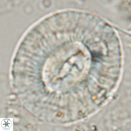 Coccolithus eopelagicus VR 027894