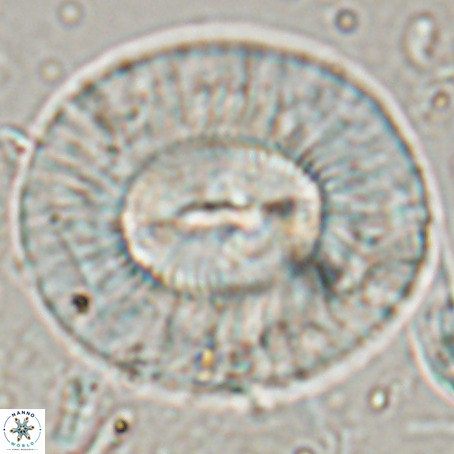 Coccolithus eopelagicus VR 027895