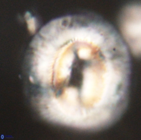 Coccolithus eopelagicus VR 32440