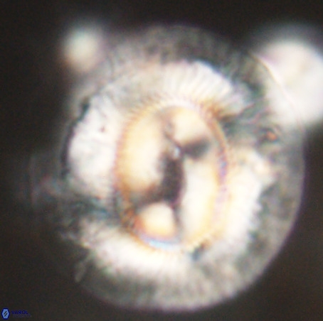 Coccolithus eopelagicus VR 32441