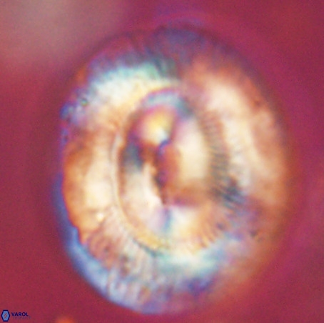 Coccolithus eopelagicus VR 32450