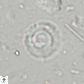 Coccolithus foraminis 43395