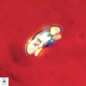 Coccolithus formosus VR 00895