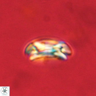 Coccolithus formosus VR 00903