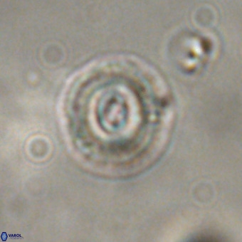 Coccolithus formosus VR 00907