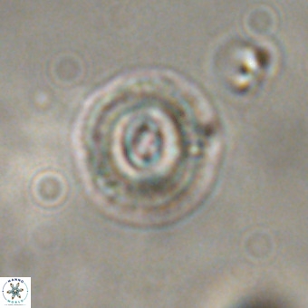 Coccolithus formosus VR 00907