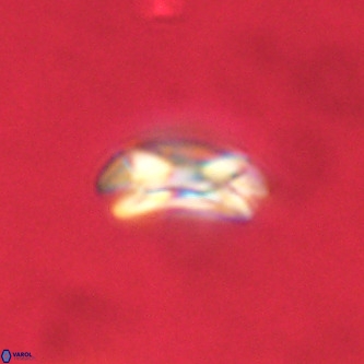 Coccolithus formosus VR 00910