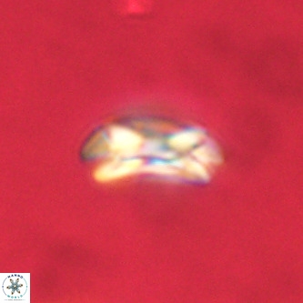 Coccolithus formosus VR 00910