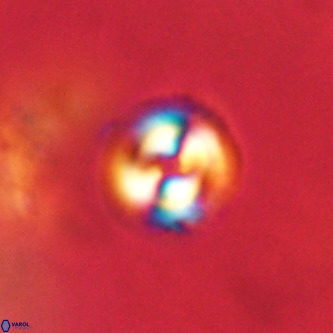 Coccolithus formosus VR 00920