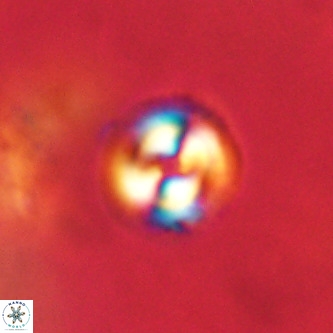 Coccolithus formosus VR 00920